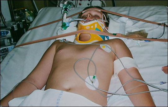 Hurt ... in hospital after horror crash